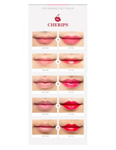 Lips Cherips ampoules STAYVE